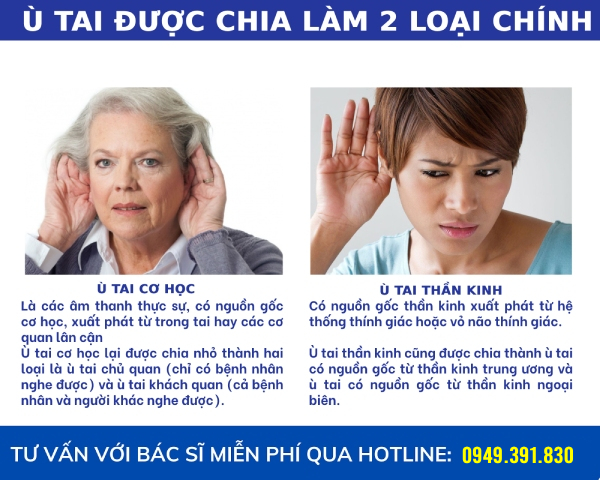 ù tai được chia làm 2 dạng